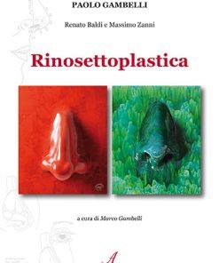 RINOSETTOPLASTICA